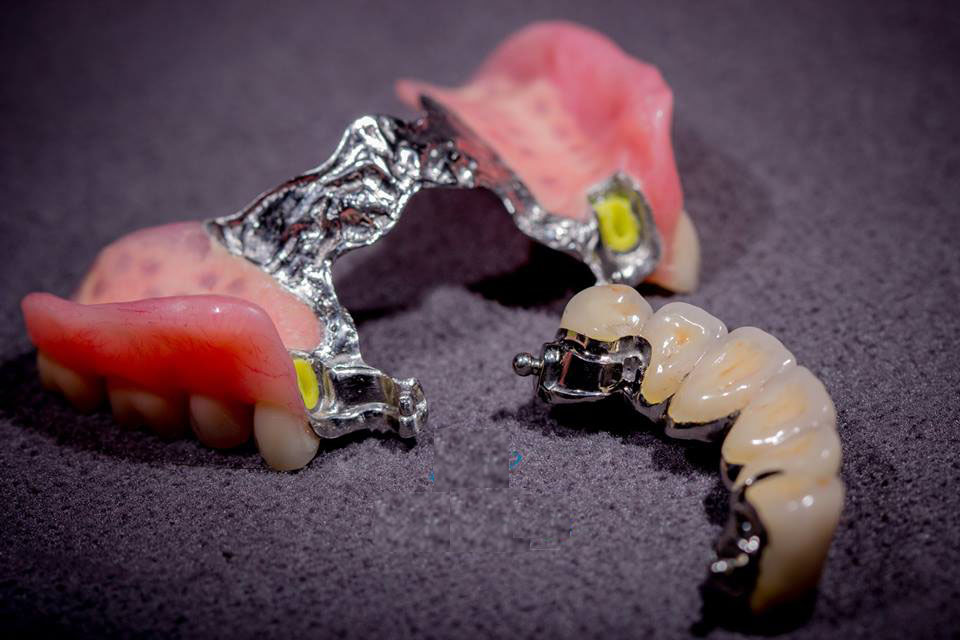 Hàm khung liên kết Hàm khung liên kết