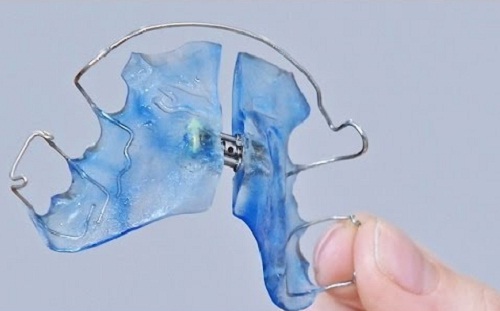 Hàm nắn ốc nong Hàm nắn ốc nong