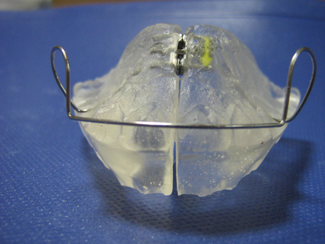 Hàm Monoblock Hàm Monoblock