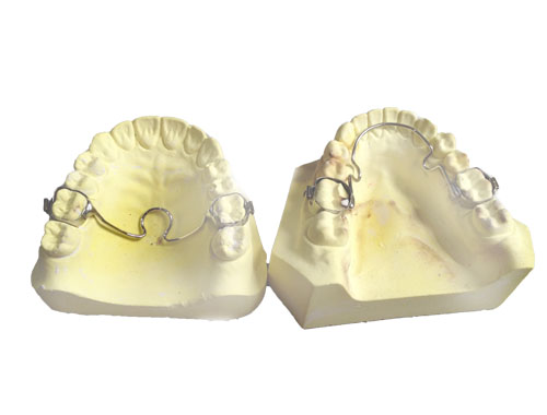 Hàm nắn cung neo Hàm nắn cung neo