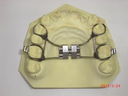 Hàm ốc nong nhanh Hàm ốc nong nhanh