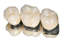 Răng sứ kim loại Cobalt Răng sứ kim loại Cobalt