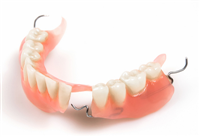 Tháo lắp nhựa cứng Tháo lắp nhựa cứng